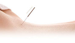 Le Shiatsu - About Acupuncture image